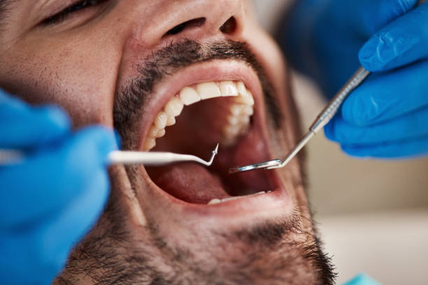Best Broken or Chipped Tooth Repair in Bryant, AR